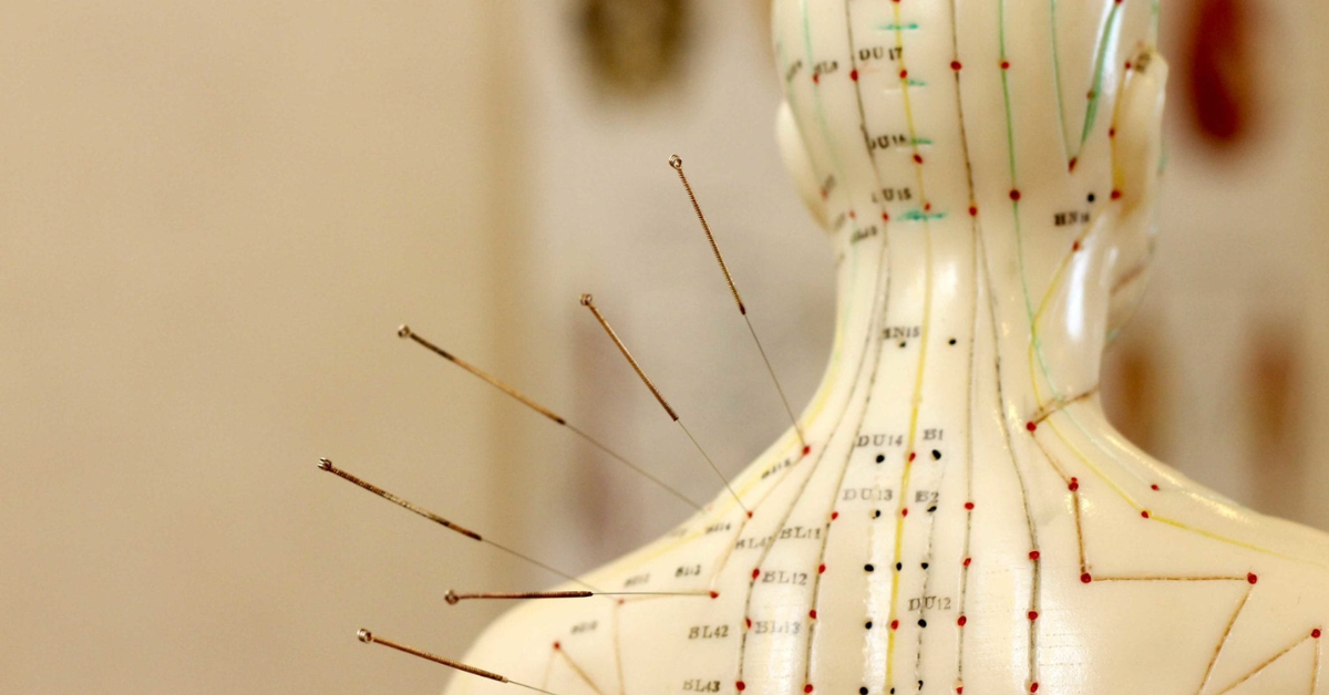 Best TCM Acupuncture